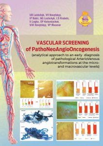 Публікація монографії Судинний скринінг ПатоНеоАнгіоОнкогенезу